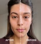 Medicube Age-R Booster Pro on mitmekülgne kodune nahahooldusseade_ mis ühendab kuut tehnoloogiat_ elektroporatsioon_ mikrovoolud_ EMS (elektriline lihasst(